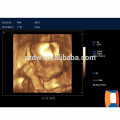 4D Farb-Doppler-Ultraschall-Preis und 3D-Farb-Doppler-Ultraschall-Scanner in Krankenhäusern eingesetzt